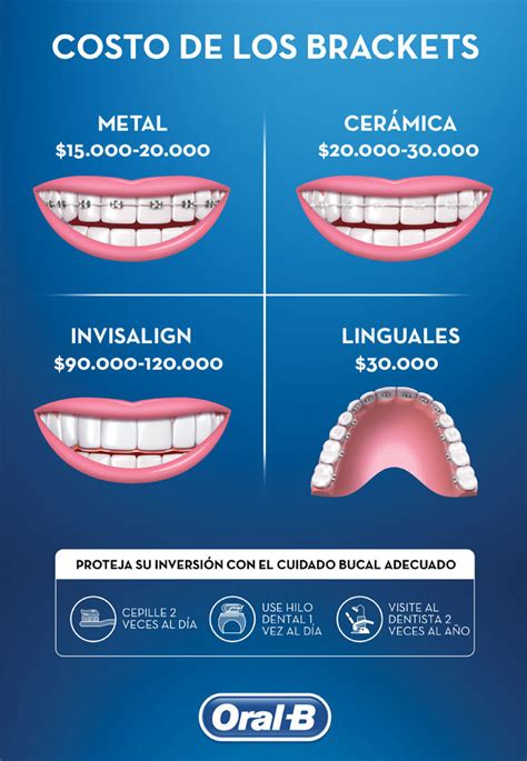 brackets metalicos precio|cuanto cuesta un bracket.